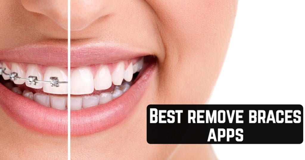11 Best remove braces apps (Android & iOS) Apppearl Best mobile