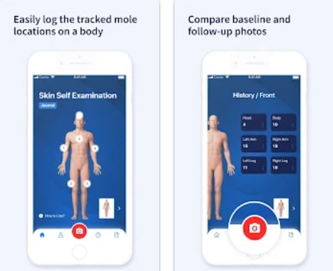 AI Dermatologist: Skin Scanner5