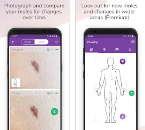 Miiskin Skin Tracker & eHealth 8