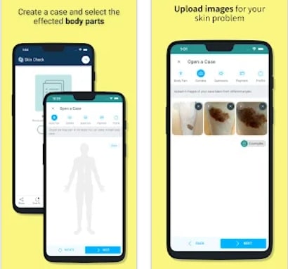 Skin Check: Dermatology App1